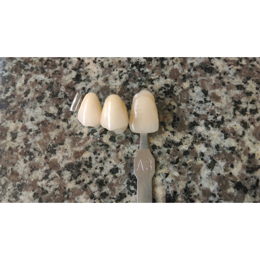 Bột sứ đắp răng Kim loại Ruyi men trong Transparent ( men chữ T) - Ảnh 10